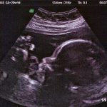 WEEK 28 OF PREGNANCY – PREGNANCY WEEK BY WEEK