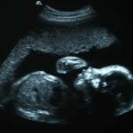 week 24 pregnancy ultrasound