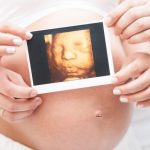 3D or 4D ultrasound