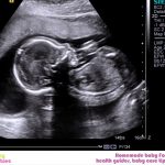 Week 41 Of Pregnancy – Pregnancy Week By Week