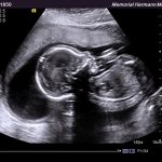 Week 41 Of Pregnancy – Pregnancy Week By Week