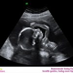 Week 42 Of Pregnancy – Pregnancy Week By Week
