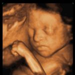 Week 42 Of Pregnancy – Pregnancy Week By Week