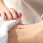 Acupuncture for fertility: is it effective?