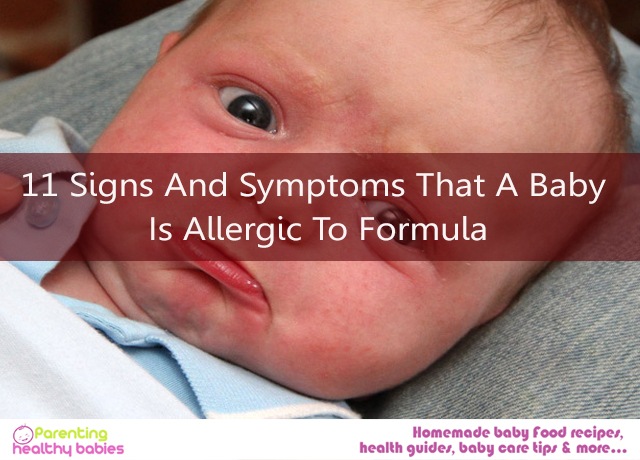 Allergic To Formula