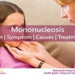 Mononucleosis: Sign, Symptom, Causes, Treatment