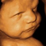 3D/4D Ultrasound During Pregnancy: Are They Safe For My Baby?