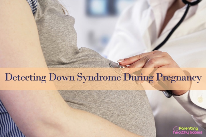 down sydrome during pregnancy