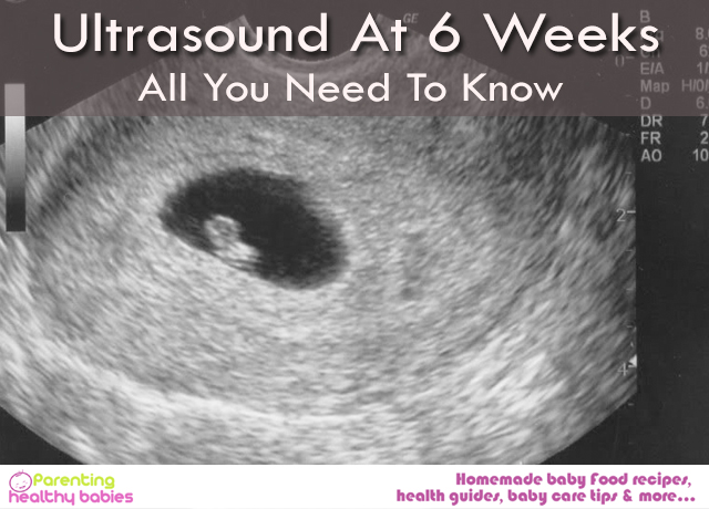 ultrasound 6 week