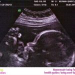 WEEK 28 OF PREGNANCY – PREGNANCY WEEK BY WEEK