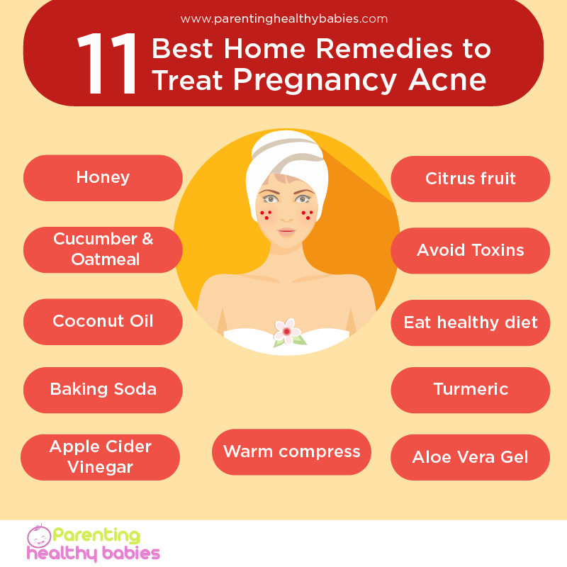 Home Remedies for Pregnancy Acne-01