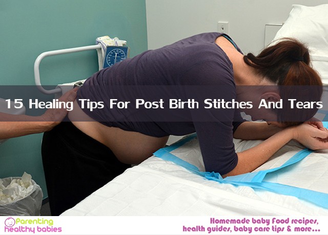 Birth Stitches And Tears
