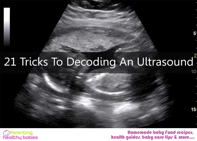 Decoding An Ultrasound