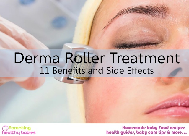Derma Roller Treatment