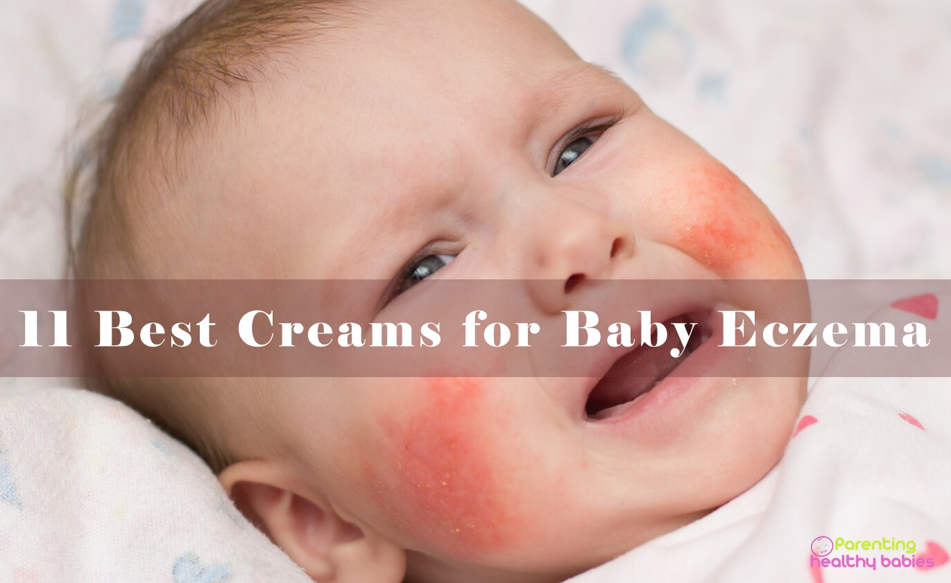 baby eczema creams