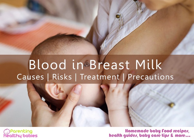 Blood in Breast Milk