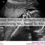 Second Trimester Ultrasound Scans: Everything You Need To Know
