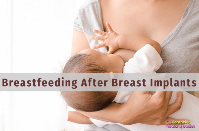 breastfeeding after breast implants