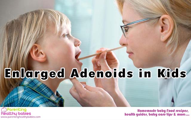 enlarged adenoids in kids