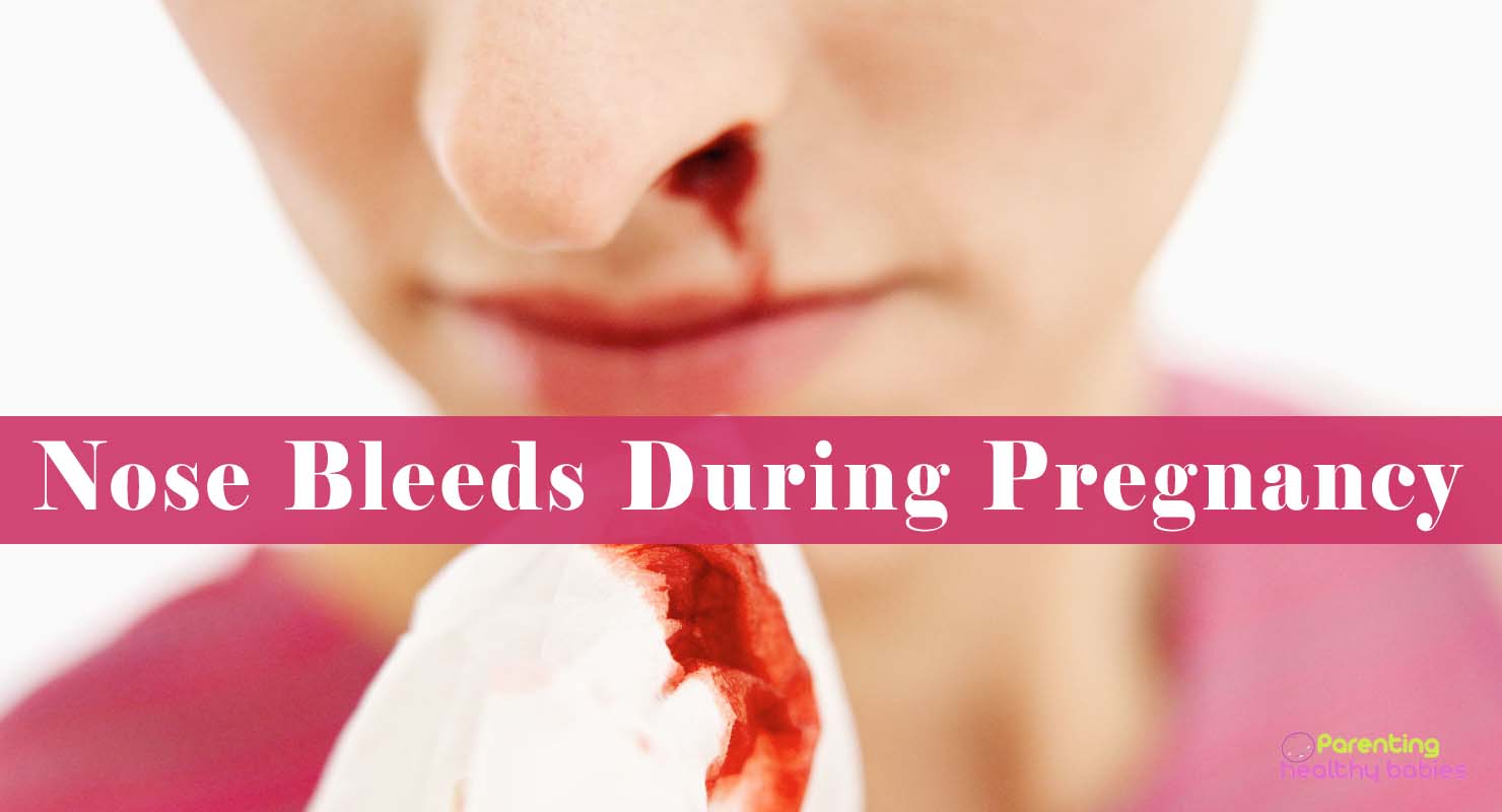 nosebleeds during pregnancy