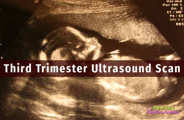 third trimester ultrasound