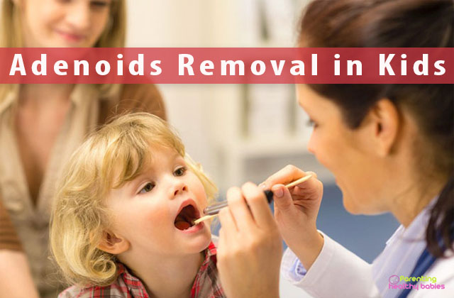 adenoids removal in kids