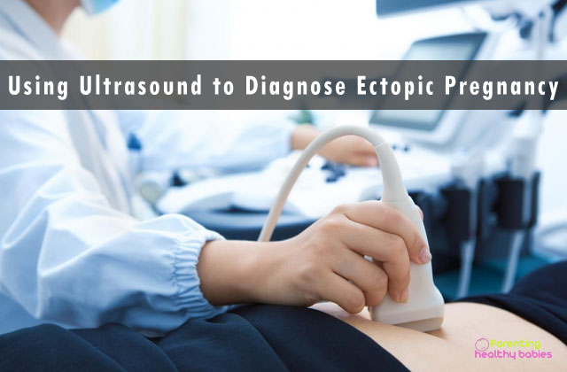 using ultrasound to diagnose ectopic pregnancy
