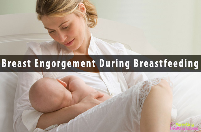 Breast Engorgement During Breastfeeding