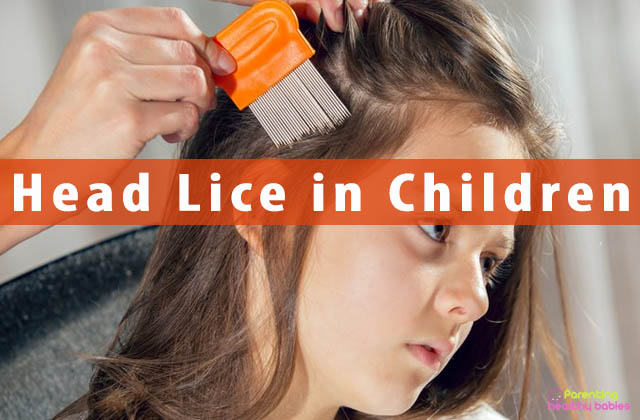 Head Lice in Children