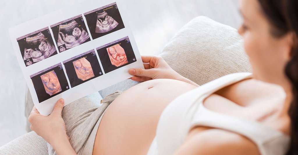 ultrasound photo