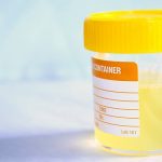mucus in urine