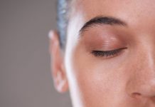 blackhead removal