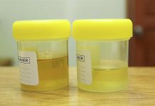 cloudy pee pregnancy