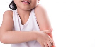 molluscum contagiosum