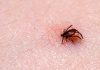 tick borne diseases