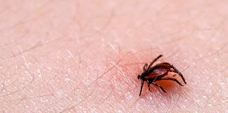 tick borne diseases