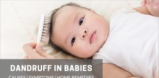 baby dandruff