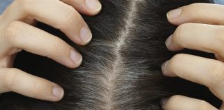 premature grey hair