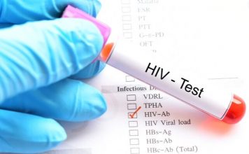 how to get tested for hiv