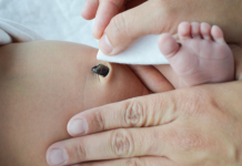 benefits of delayed cord clamping