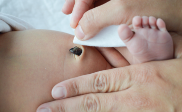 benefits of delayed cord clamping