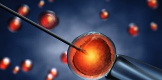 intracytoplasmic sperm injection icsi