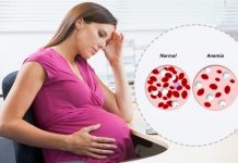 anemia during pregnancy