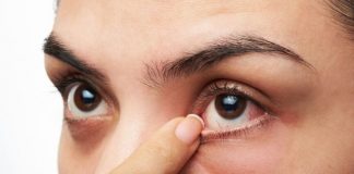 eye twitch pregnancy
