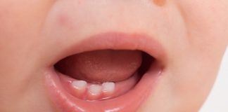 baby born with teeth
