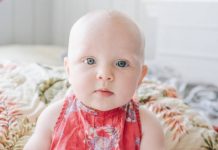 bald baby