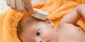 Hair Fall in Babies