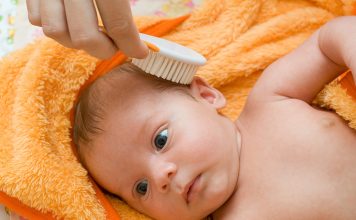 Hair Fall in Babies