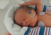 Baby Born At 32 Weeks