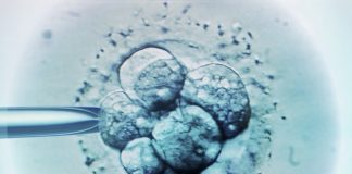 embryo transfer